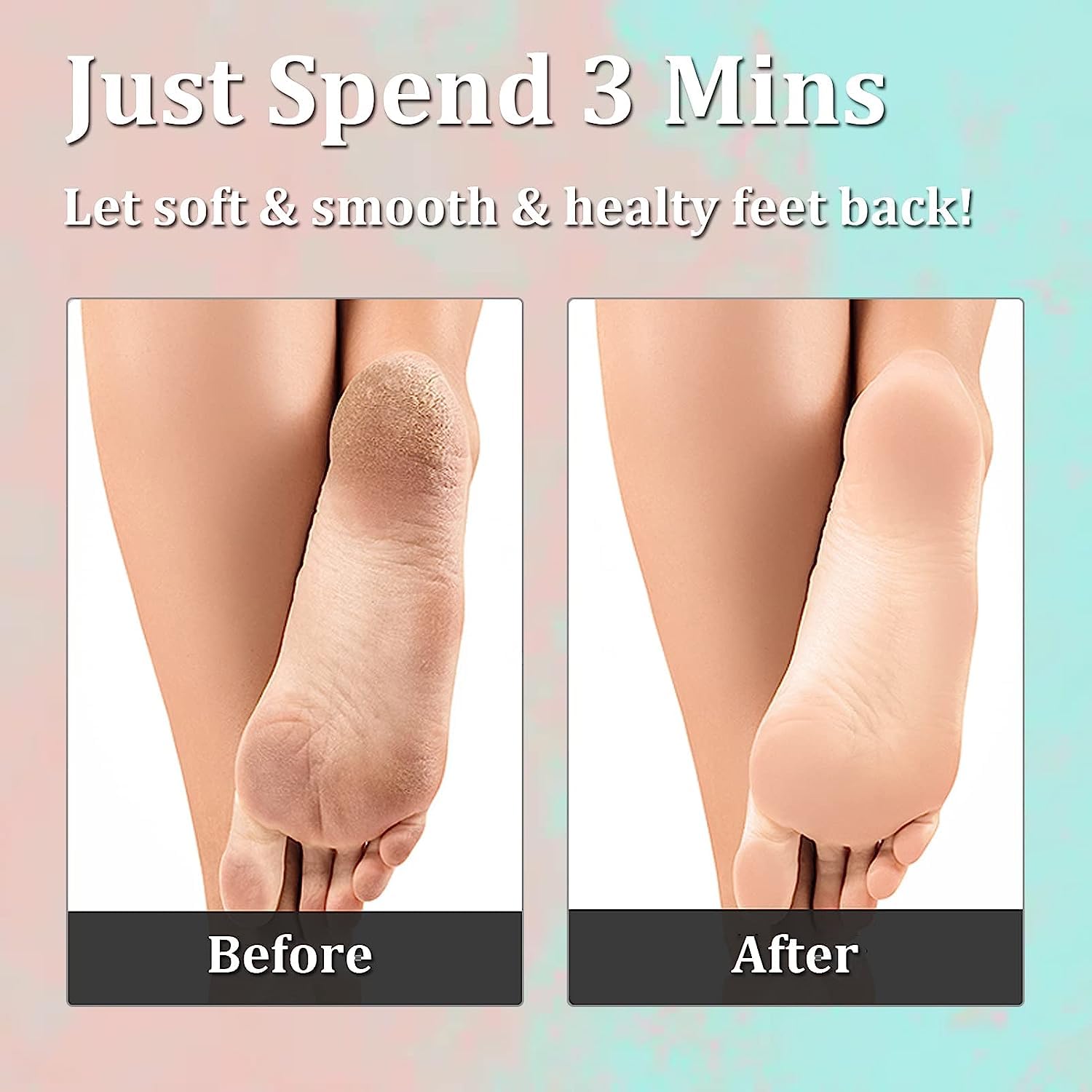 SHFTI Double-Sided Foot File,Foot Rasp File Hard Skin Remover Foot Scrubber Foot File Callus Remover Foot Care Pedicure Tool for Wet and Dry Cracked Feet (BLACK) 2
