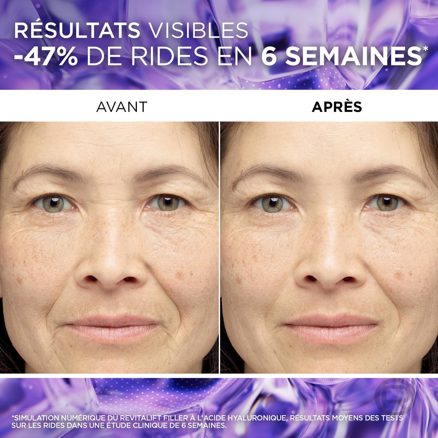 L'Oréal Paris Revitalift Sérum Anti-Rides Hyaluronique - Hydratant & Lissant pour Tous Types de Peaux (30ml) - Description