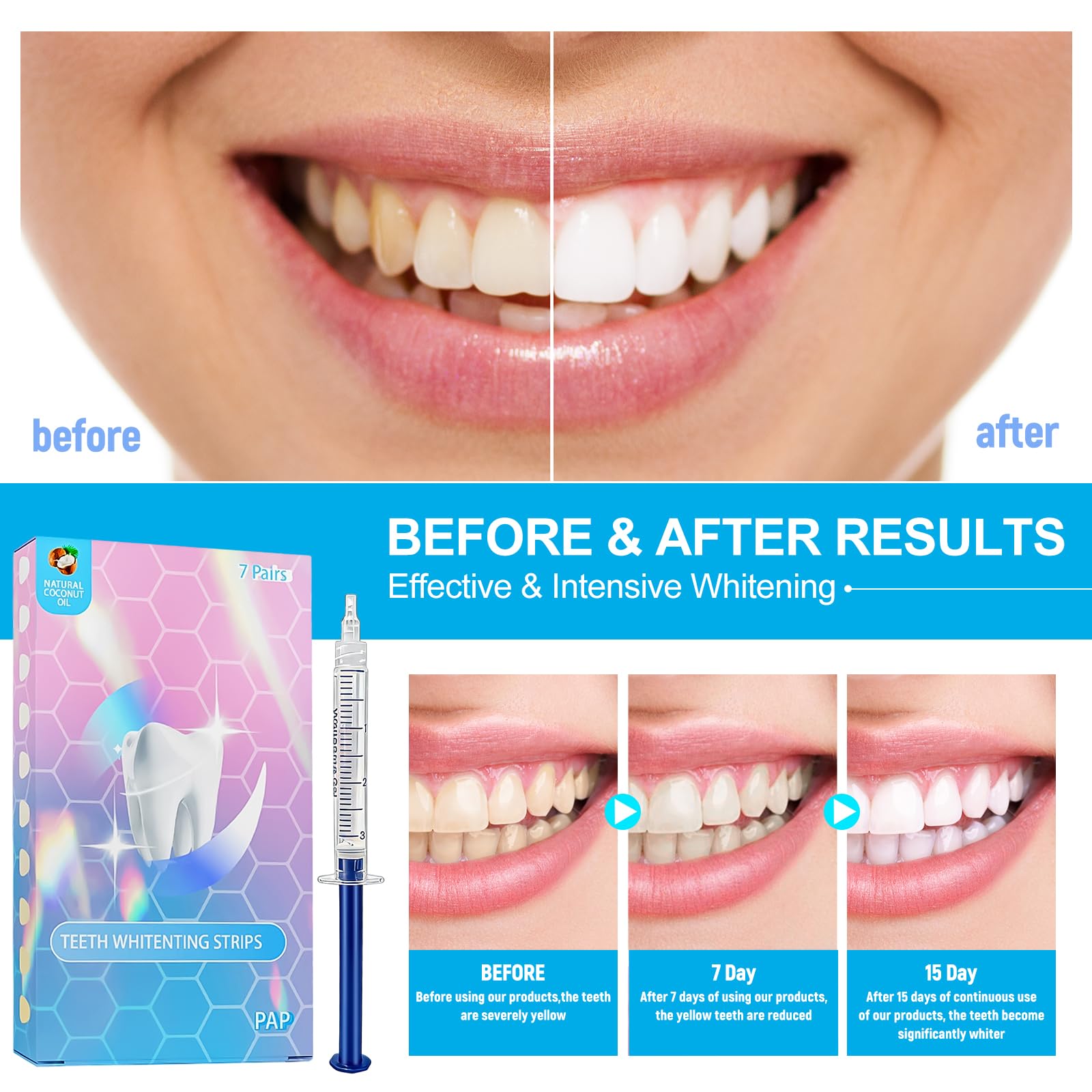 Kit Sbiancante Denti Professionale,7 pezzi Gel Denti sbiancante,Strisce Sbiancanti denti Professionali,Set Sbiancante per denti a Casa,con applicazione semplice e veloce