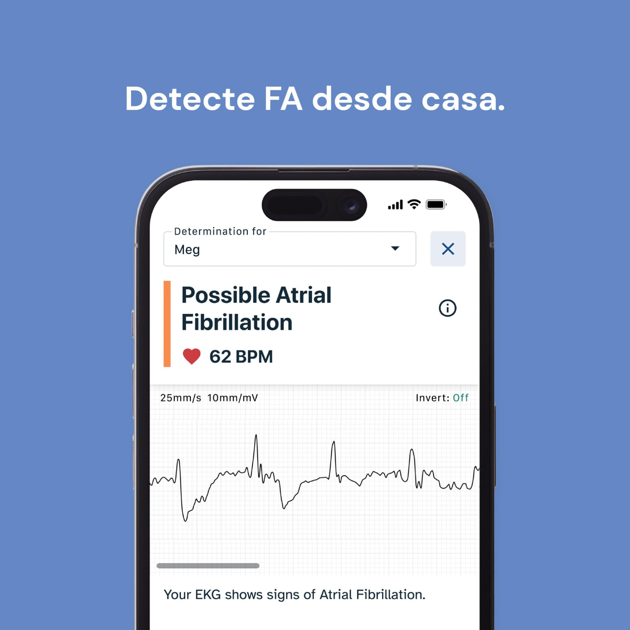 KardiaMobile Electrocardiografo Personal de 1 derivación - Registre ECG en casa - Detecta fibrilación Auricular - Resultados en 30 Segundos - Funciona con la mayoría de los Smartphones