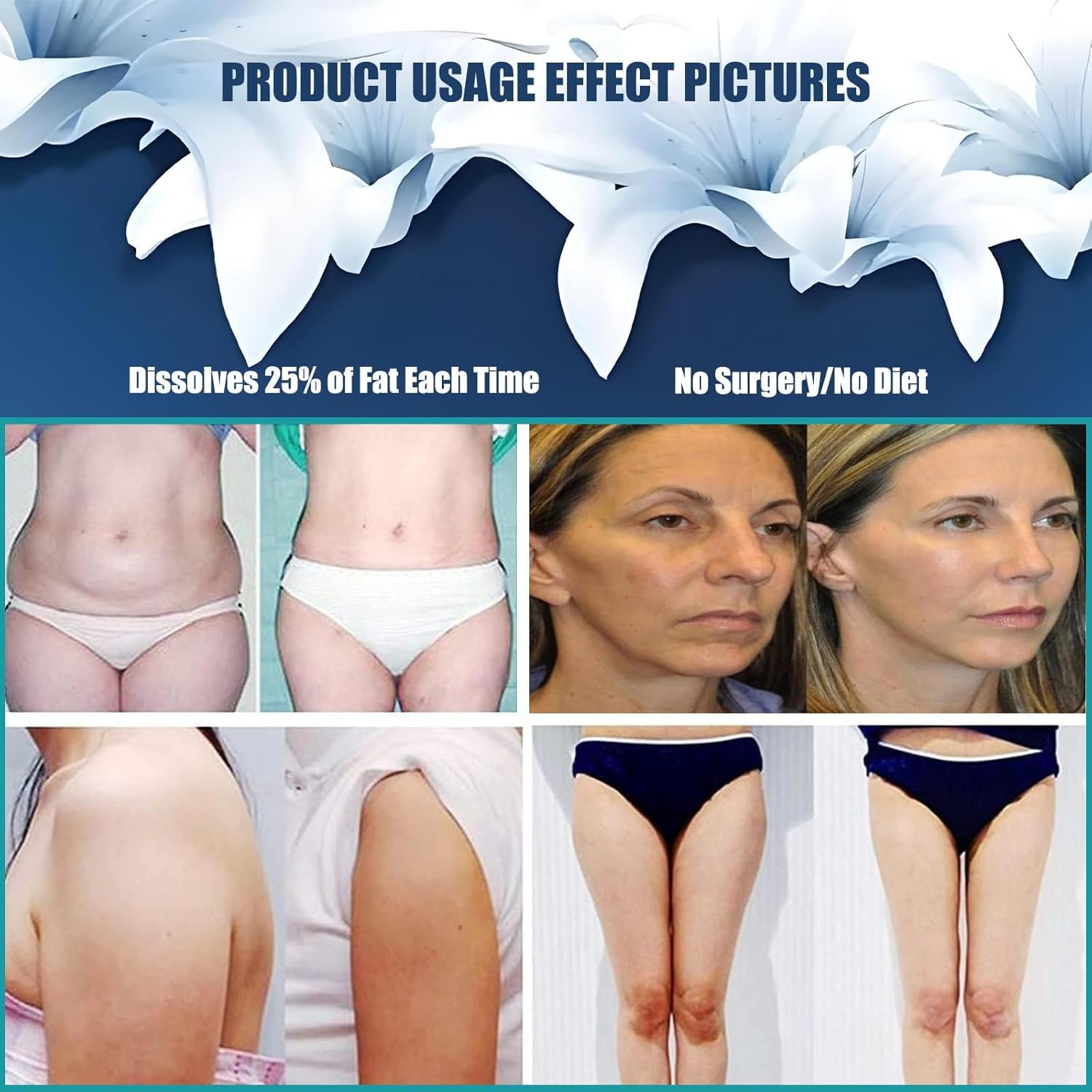 Dispositivo De Masaje Por Vibración G5 Con 5 Cabezales, Máquina De Eliminación De Masajeador De Grasa, Equipo De Belleza Portátil Para Quemador De Grasa Para Brazos, Cintura Y Piernas