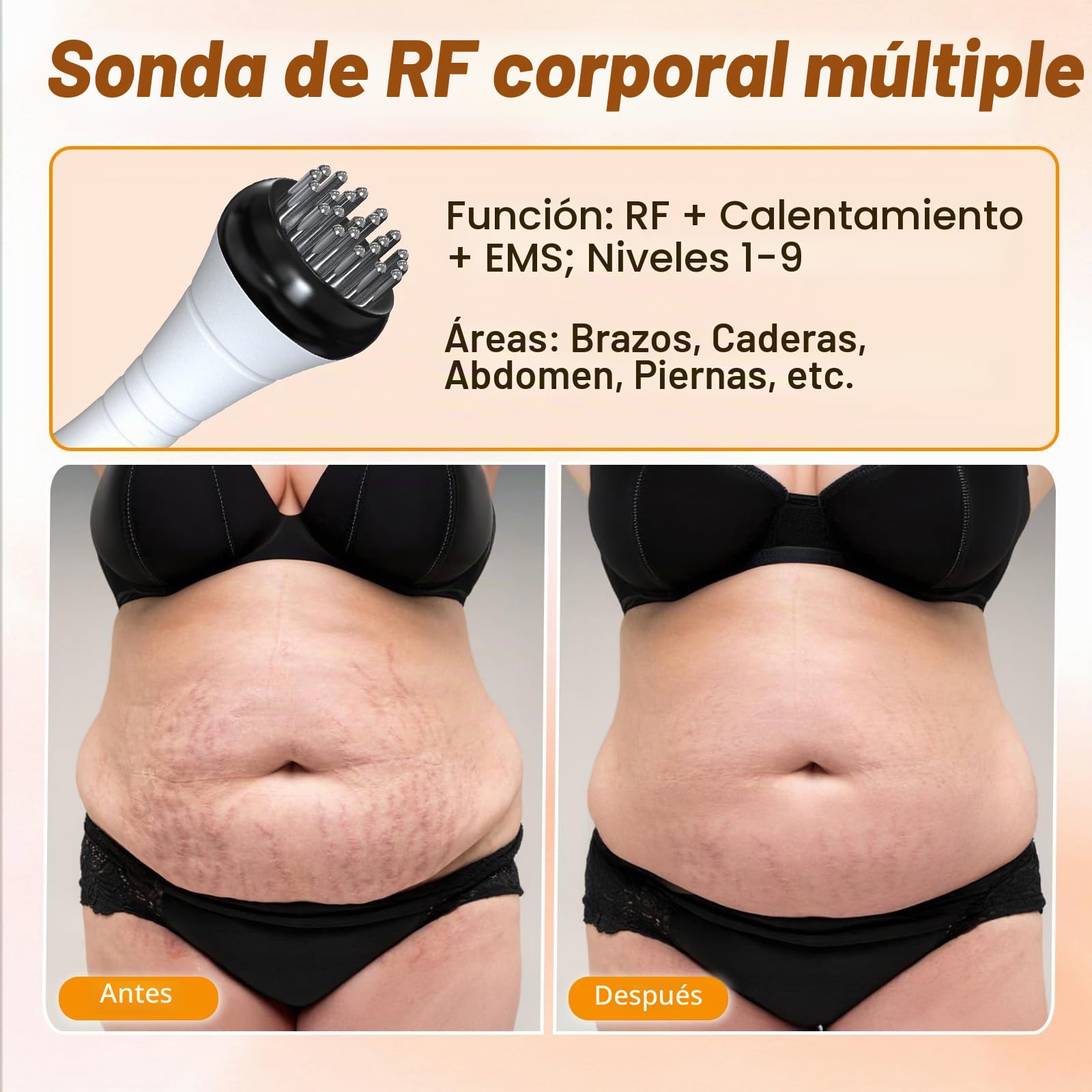 Anticelulítico 3 en 1 40K Cavitación EMS | RF 9 niveles, ventosas cuerpo y rostro, modelado y cuidado suave en casa