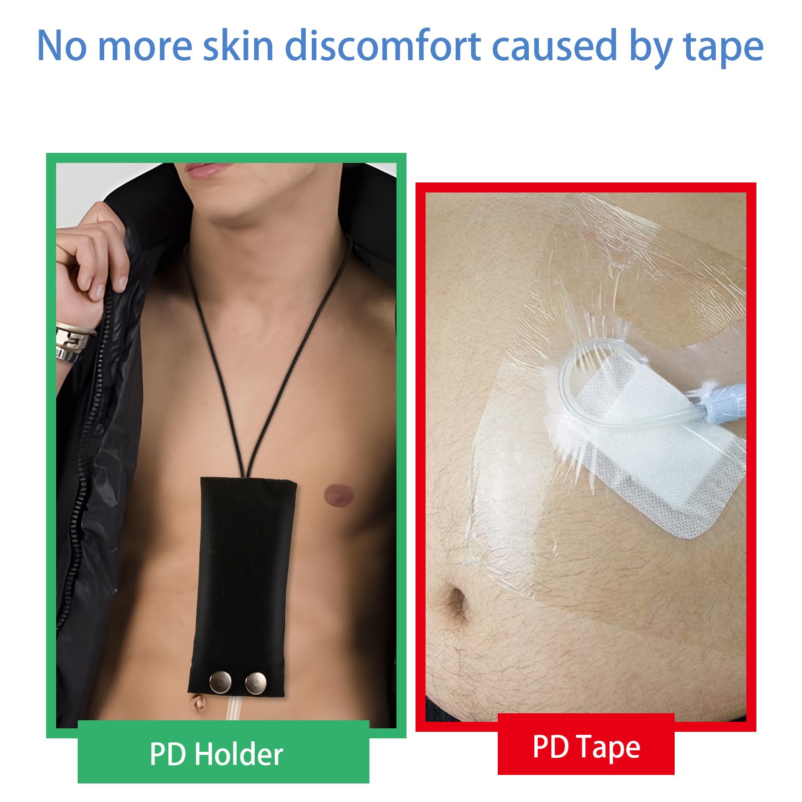 Soporte de catéter de diálisis peritoneal para Baxter 5C4482 5C4483, Cordón para catéter PD Soporte seguro para ducha PD Set de transferencia PD Soporte de catéter Accesorios para hombres y