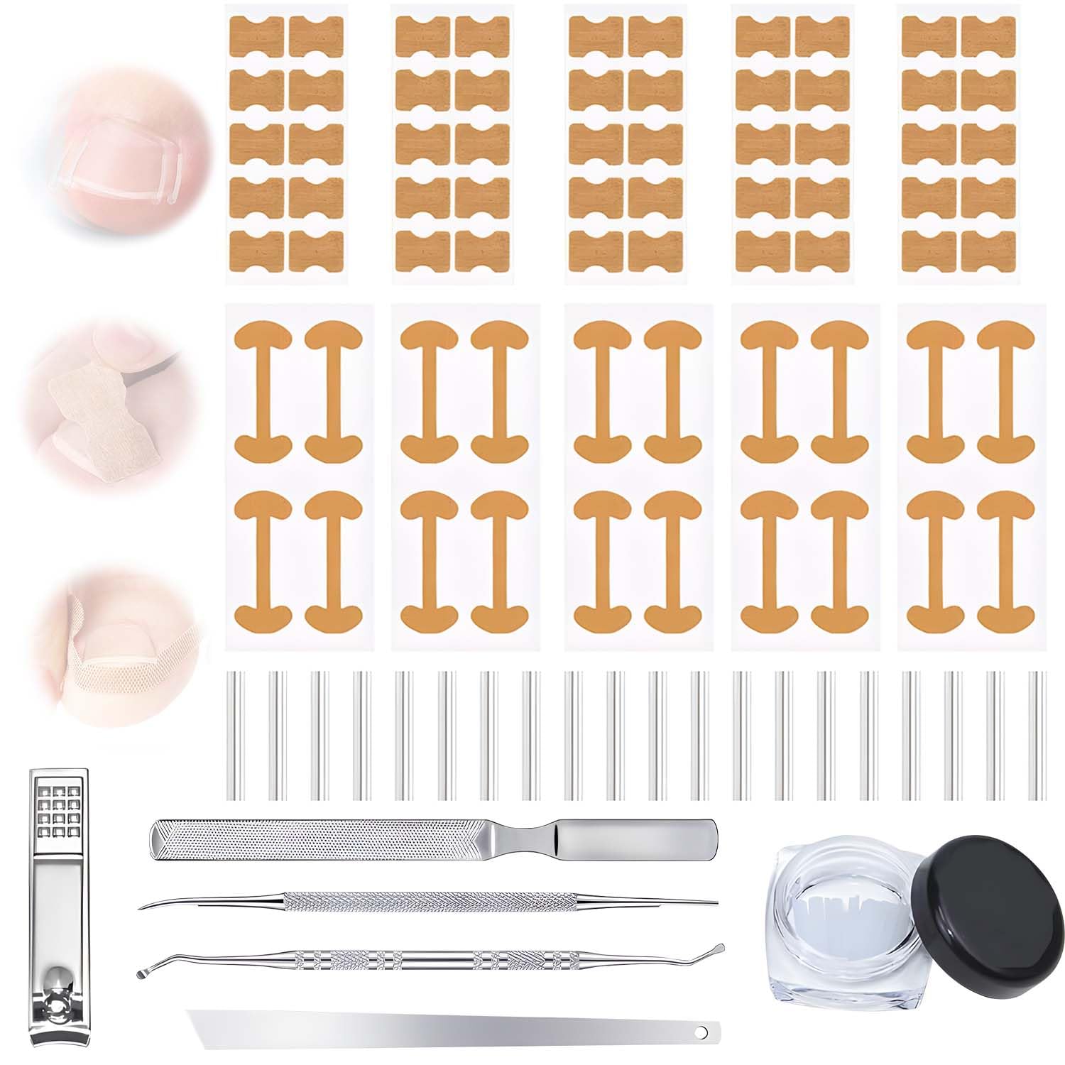 Professional Ingrown Toenail Corrector Kit with Correction Strips,Ingrown Toenails Pedicure Tool Set, Toenail Correction Strips & Ingrown Toenail Corrector for Home Pedicure Care for Women Men