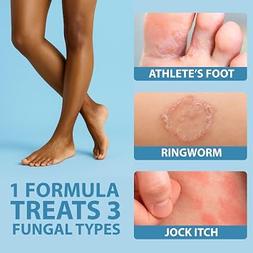 Curist Terbinafine Cream Antifungal 2 oz (2 x 1oz) Foot Fungus Treatment 1% | Anti Fungal for Foot Care, Ring Worm & Jock Itch - Athlete's Foot Cream Terbinafine Hydrochloride 1% (2 Pack of 1 oz Tubes)
