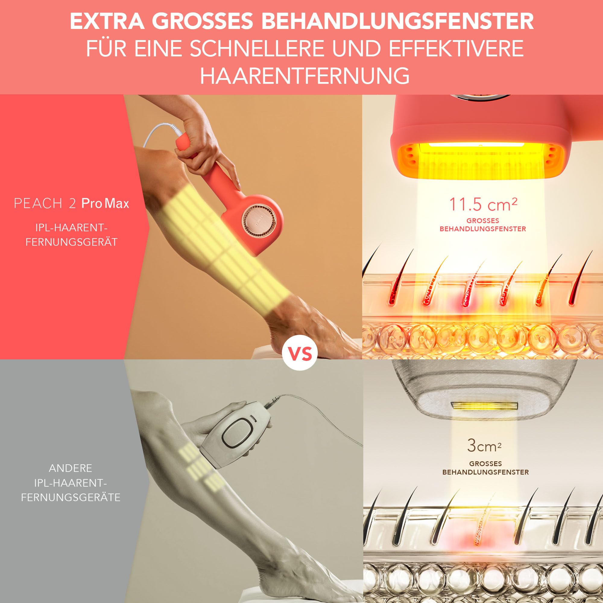 FOREO PEACH 2 Pro Max IPL-Haarentfernungsgerät - Beauty & Pflege