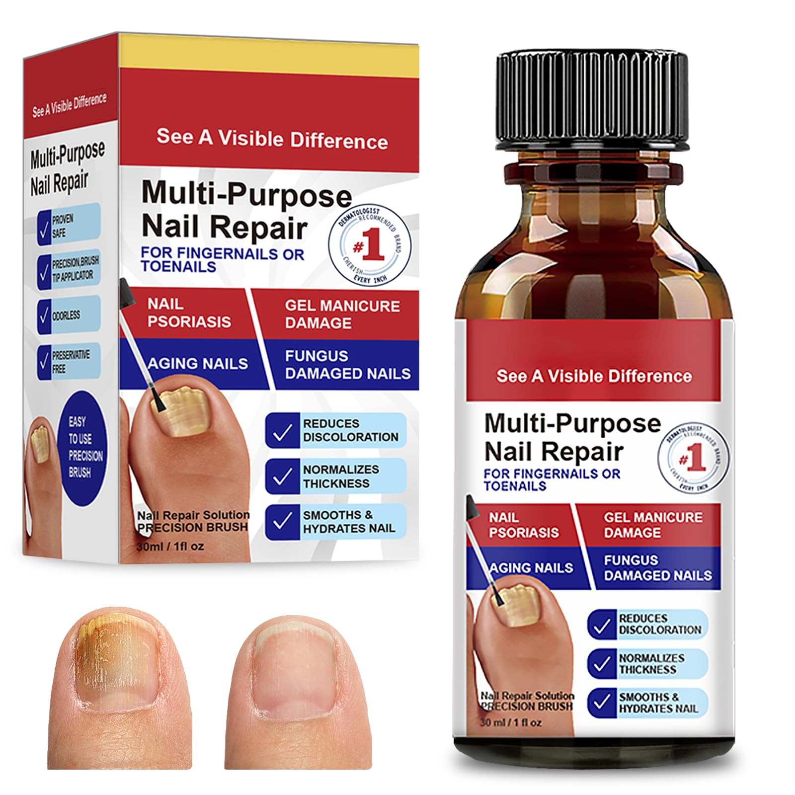 30ml Riparazione Unghie,Soluzione per la Cura delle Unghie,Liquido Cura unghia,per Migliorare l'Aspetto delle Unghies e Rinforzare la Struttura dell'Unghia,Uso Quotidiano