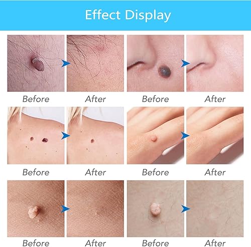 Miniatura 3 de Herramientas de 8 piezas sin rasguños Kit de plástico para apariencia, embellecer