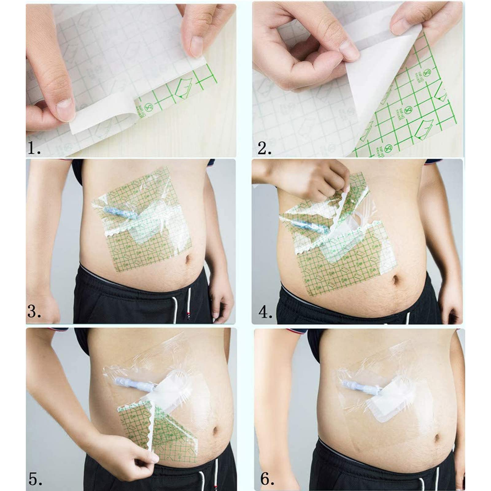Protettore Per Doccia Per Dialisi Peritoneale, Accessorio Per La Pelle Di Fissaggio Con Pellicola Trasparente, Cerotto Per Dialisi Peritoneale Impermeabile Per Porta Di Dialisi,100pcs