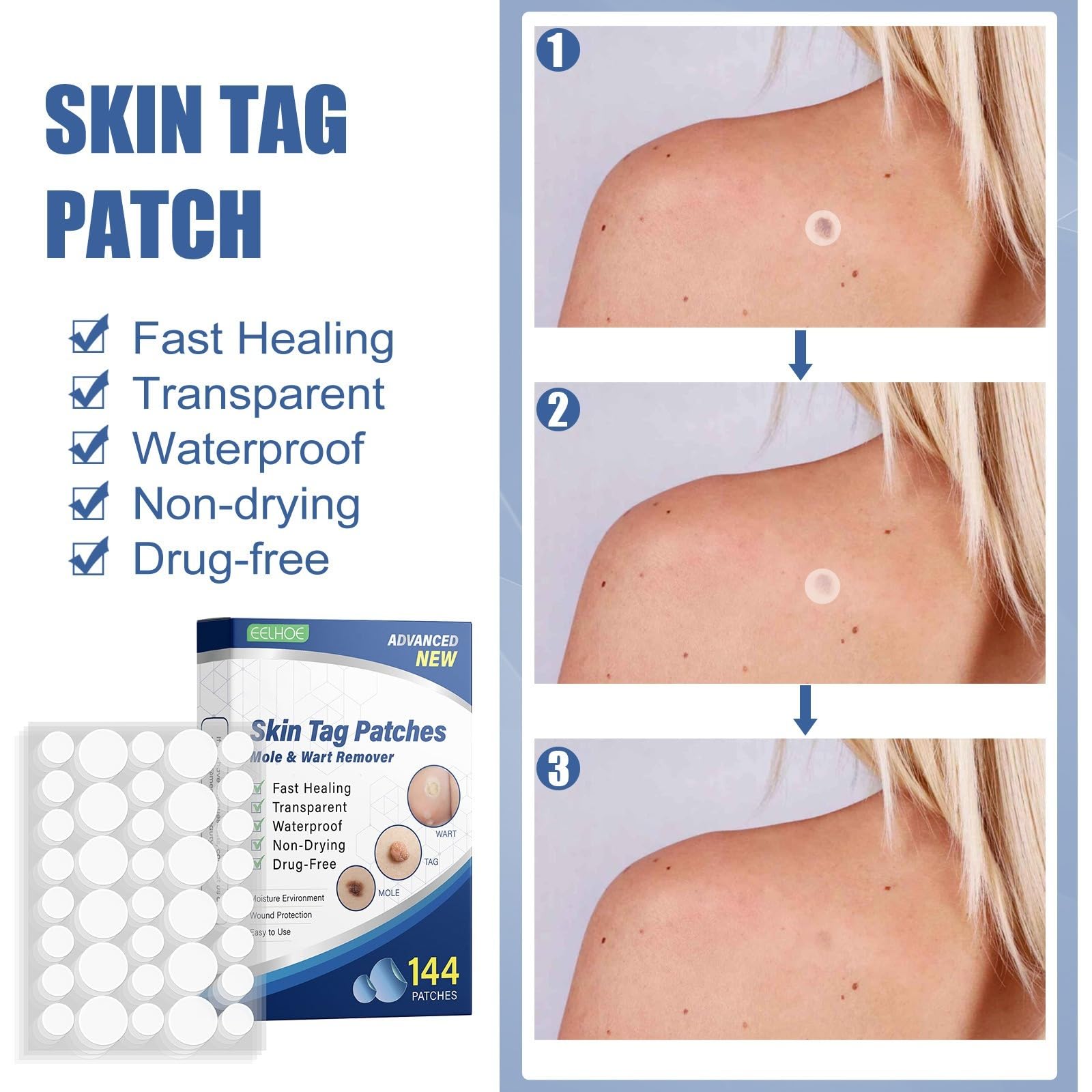 Microneedle & Hydrokoloid, Pimple Patch, długopis do pielęgnacji twarzy, | Usuwacz do plam i skórnych narośli, naturalne składniki, dla kobiet i mężczyzn Haczyki do haczyków, łatwe w użyciu,