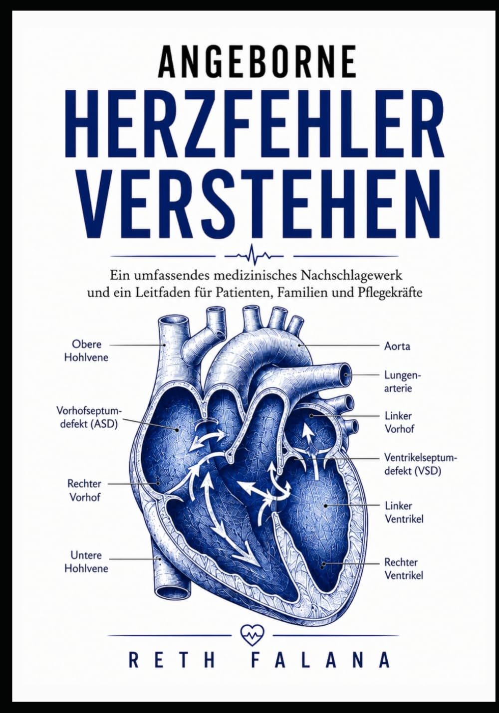 Angeborene Herzfehler verstehen: Ein umfassendes medizinisches Nachschlagewerk und ein Leitfaden für Patienten, Familien und Pflegekräfte (Die Reihe ... Herzerkrankungen erklärt)