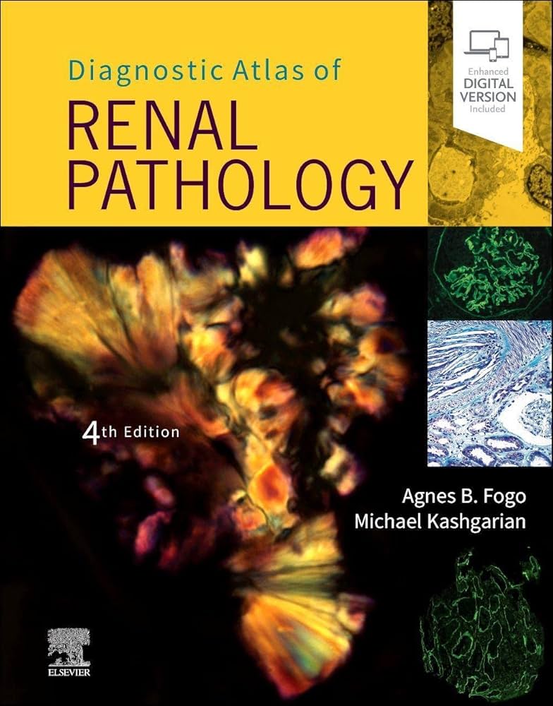 健康・医学 Diagnostic Pathology Kidney Diseases Diagnostic Pathology: Kidney Diseases: 9780443107177