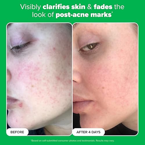 Miniatura 5 de Paula's Choice BOOST 10% Azelaic Acid Booster Cream Gel Face Serum with Salicylic Acid, Oil-Free Skin Brightening Serum for Face, Fragrance-Free