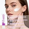 2 Pcs 12% Azelaic Acid Cream,Rosacea Cream for Face,Revitalize Your Complexion Facial Serum,Gentle and Moisturizing for all Skin Pigmentation Redness