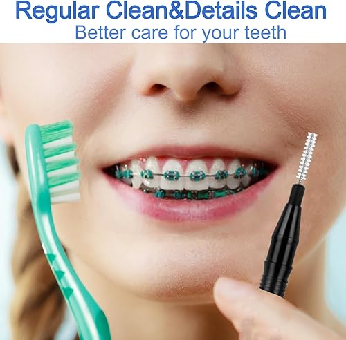 Miniatura 7 de HEOIZI 100 cepillos interdentales de 2 tamaños, cerdas suaves flexibles de 360, cepillos dentales entre dientes, cepillos interdentales para encías,