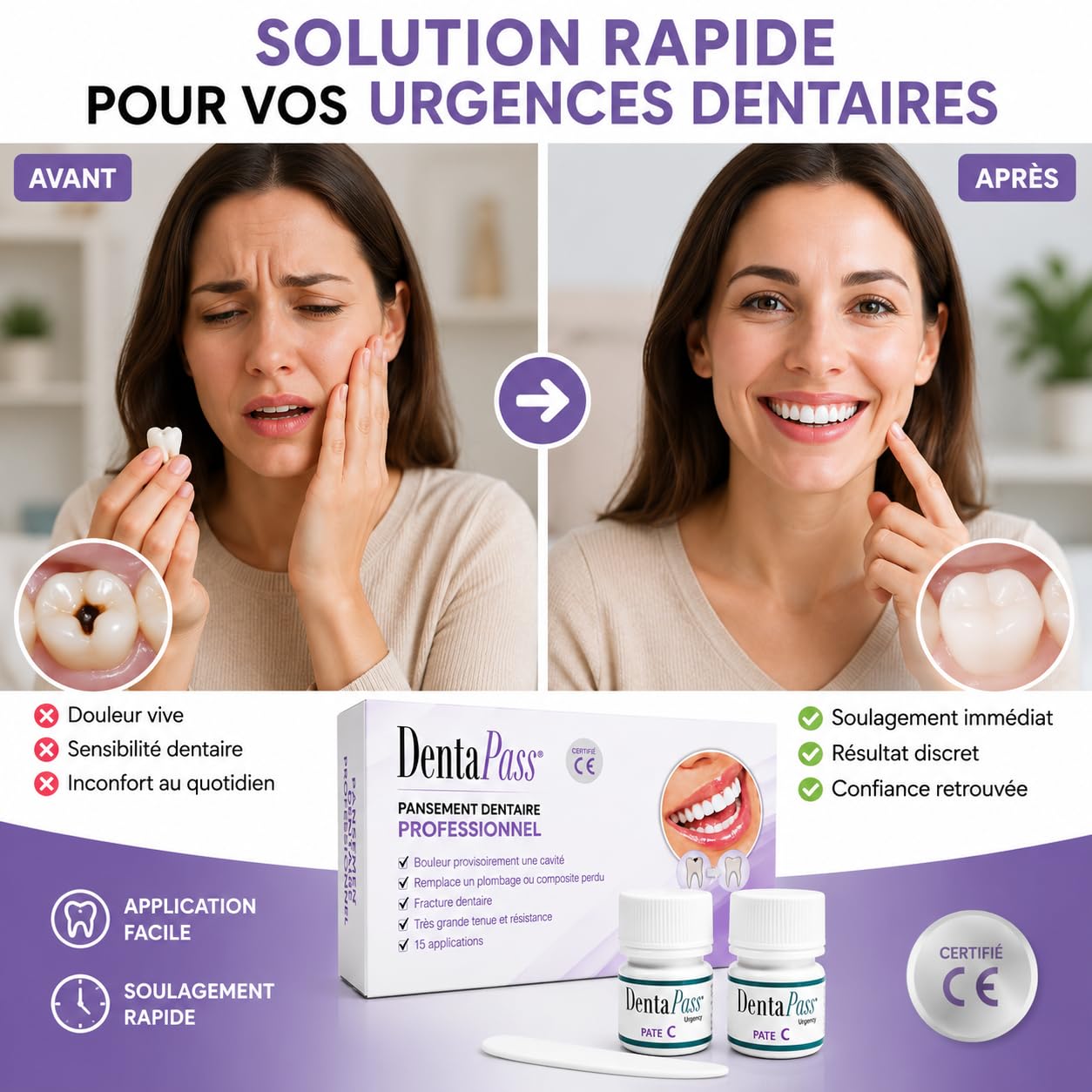 Pansement Dentaire | Pansement dentaire provisoire | Reboucher une Carie, Amalgame, Trou dans une Dent | Rage de Dent | Qualité Professionnelle | Application Facile | Certifié CE | Entreprise FR
