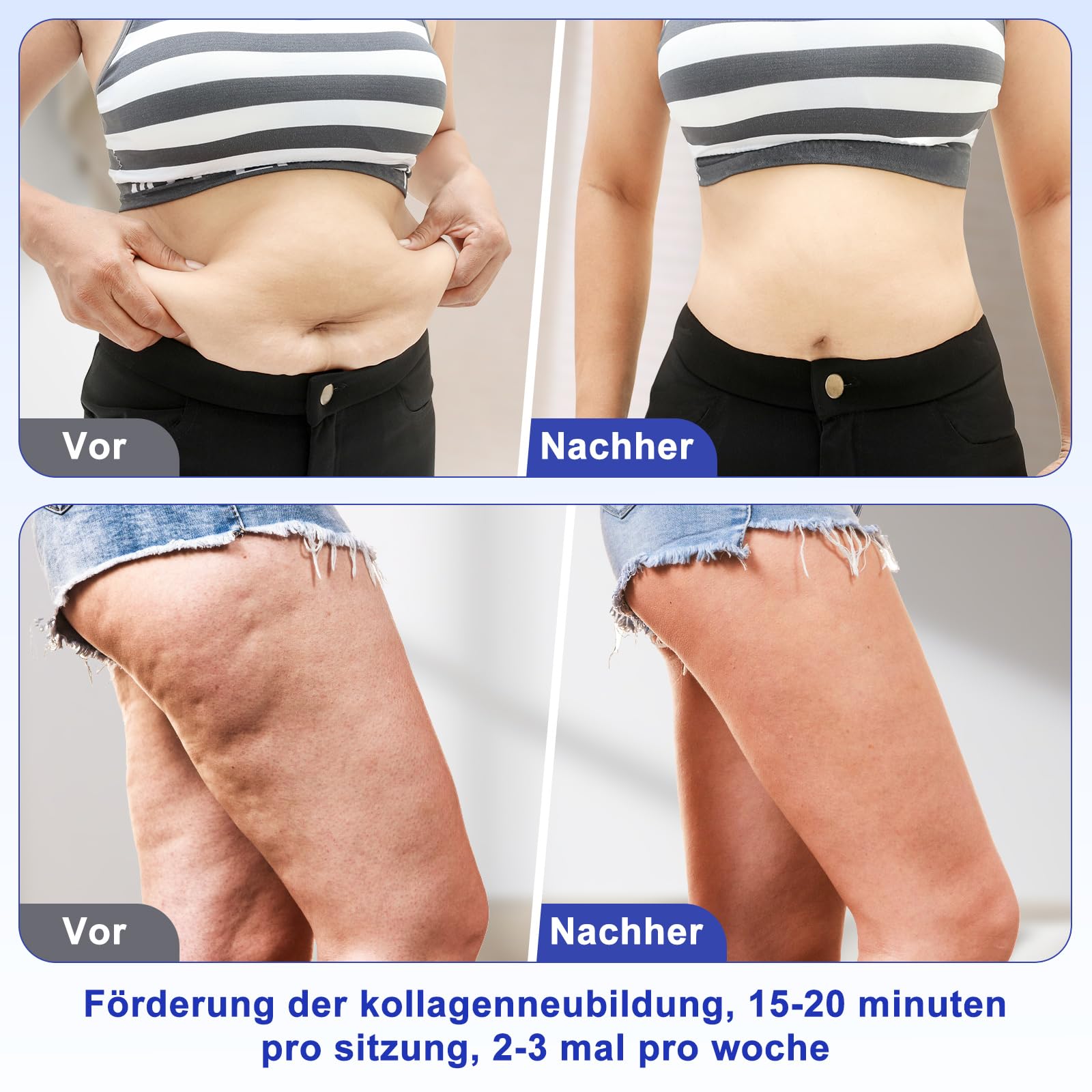 40K Massagegerät, 4-in-1 Ultraschall- und Radiofrequenzgerät, Schönheitsgerät für Gesicht und Körper zur täglichen Hautpflege