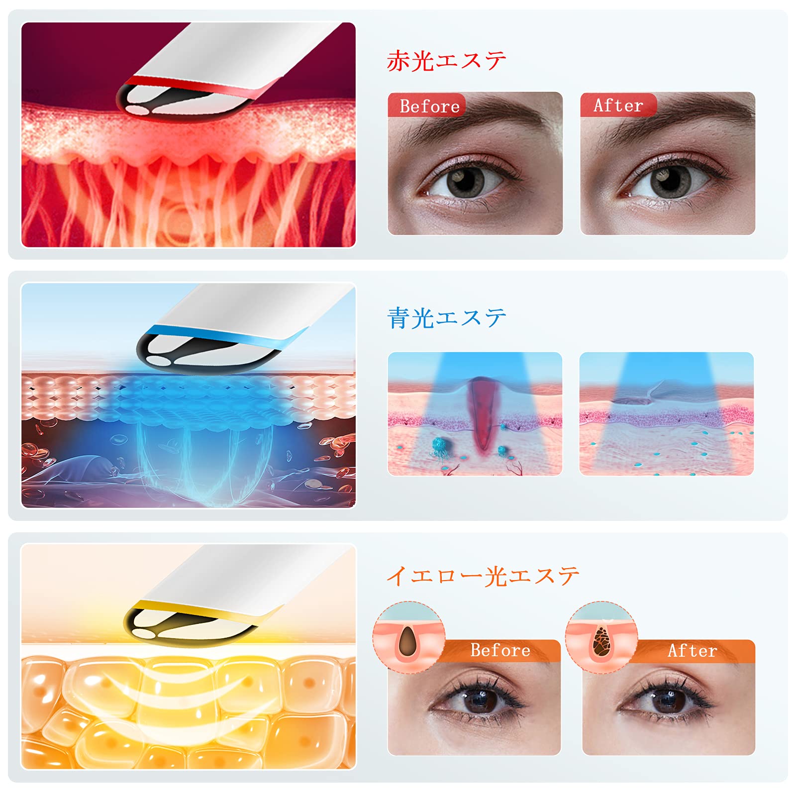 Amazon.co.jp: ANLAN 目元ケア 美顔器 温熱ケア 3種類光エステ 振動