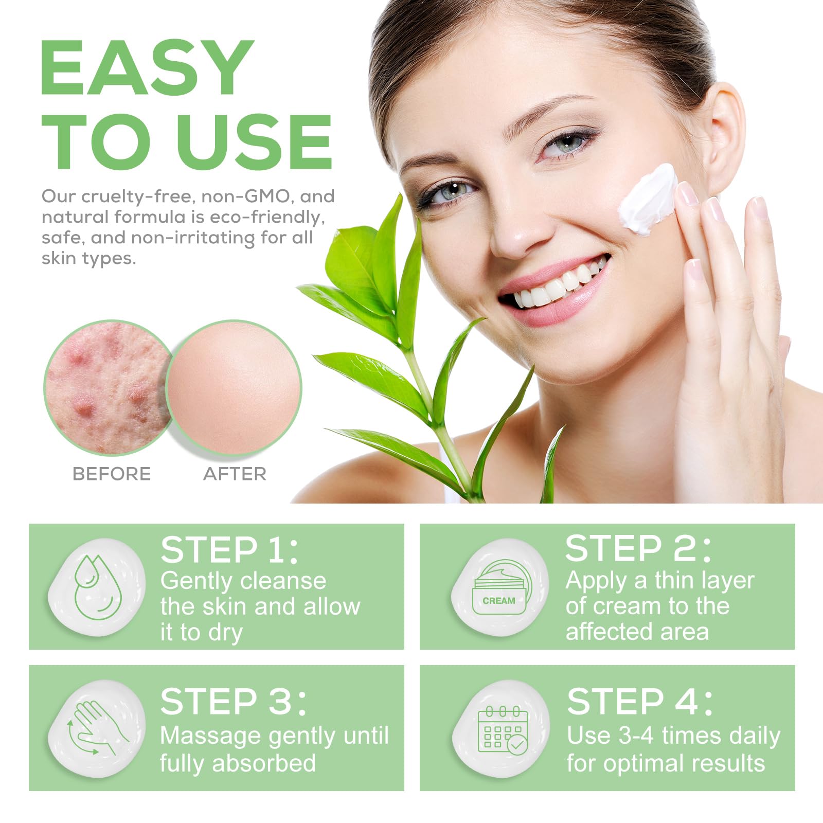 Crema Urea, Urea Crema al 40%, con Acido Ssalicilico al 2% e Acido Ialuronico, Melaleuca e Aloe Vera per Un'idratazione Profonda, per Piedi, Mani, Talloni, Gomiti, Unghie e Ginocchia