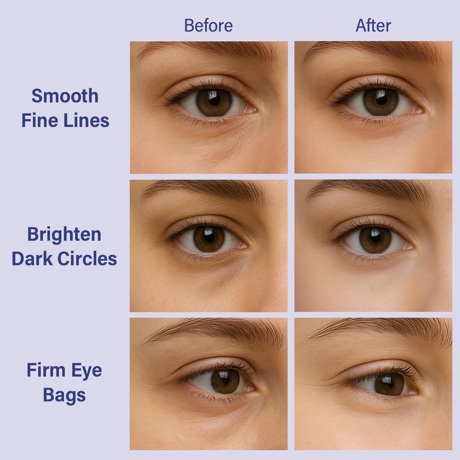 Tintark Patch Occhi Diamond Gaze 28 Paia – Hydrogel Eye Mask con Retinolo, Niacinamide e Acido Poliglutammico, Idratante Illuminante, Anti-Rughe e Rimpolpante, Cura di Sé e Relax