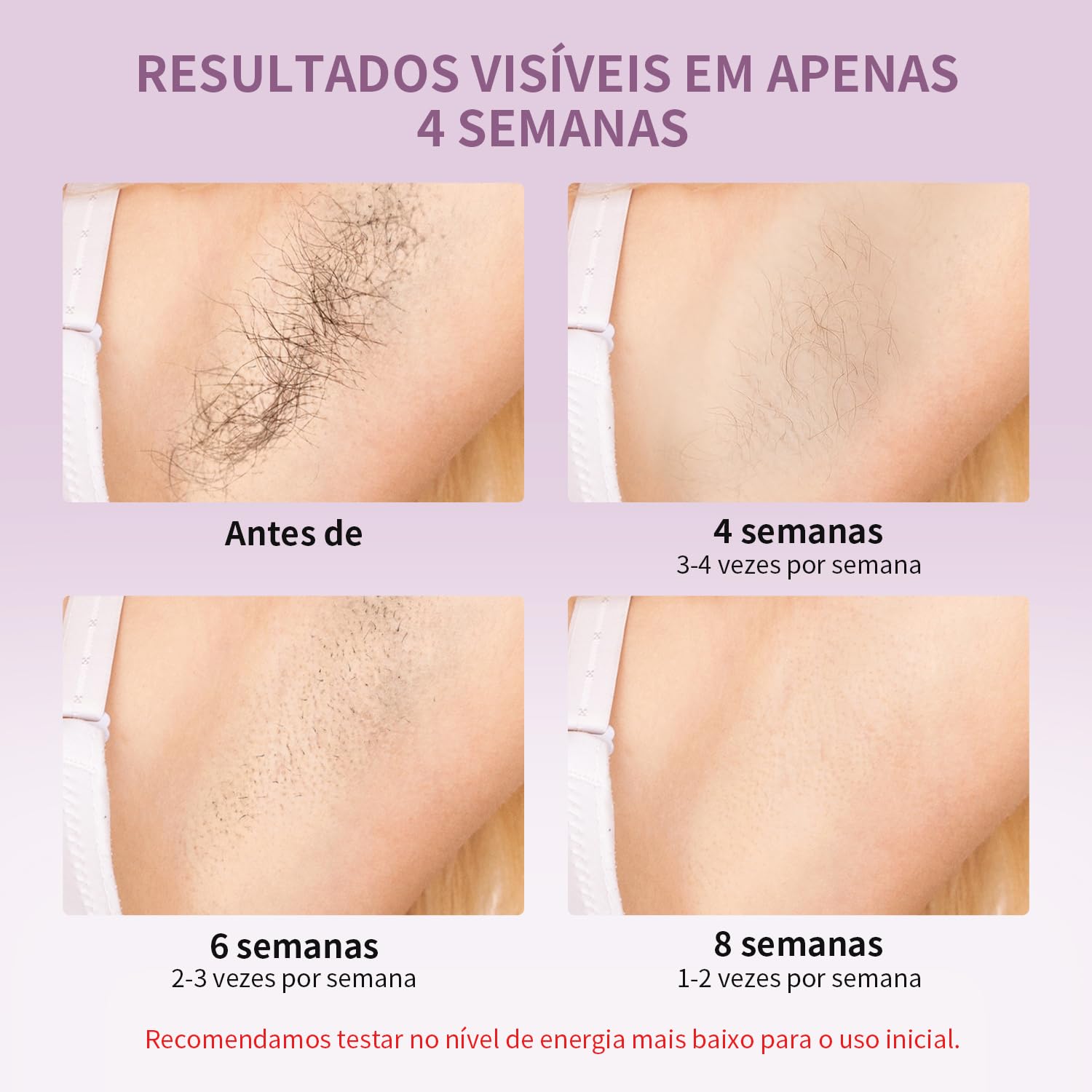 Depilador a Laser IPL com Resfriamento MLAY T14, Aprovado pela ANVISA, Luz Pulsada para Uso Doméstico, 1,5 Milhão de Flashes, Unissex, Depilação Eficiente para Rosto, Axilas e… em promoção! Veja a oferta e mais achadinhos de Depilação 5 Hoje é o melhor dia para comprar Depilador a Laser IPL com Resfriamento MLAY T14, Aprovado pela ANVISA, Luz Pulsada para Uso Doméstico, 1,5 Milhão de Flashes, Unissex, Depilação Eficiente para Rosto, Axilas e… com aquele preço maroto! Promoção! Aproveite a oferta! 5