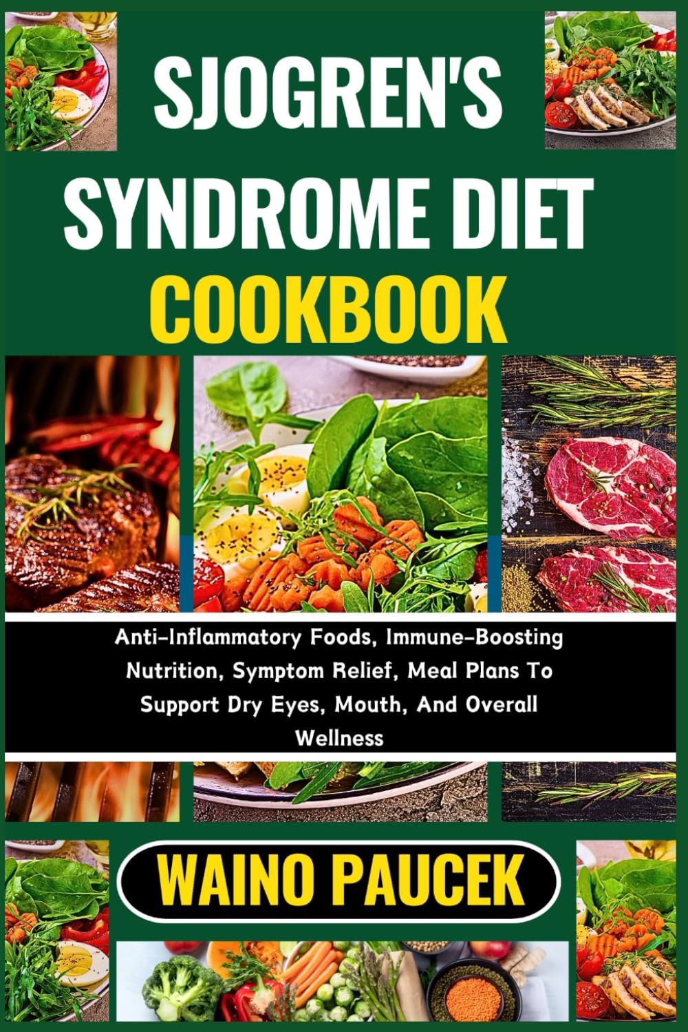 SJOGREN'S SYNDROME DIET COOKBOOK: Anti-Inflammatory Foods, Immune-Boosting Nutrition, Symptom Relief, Meal Plans To Support Dry Eyes, Mouth, And