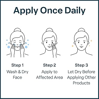 QRxLabs Glycolic/Salicylic Acid 10/2 Acne Control Pads with 10% Ultra Pure Glycolic Acid + 2% Salicylic Acid USP, Allantoin, Vitamins B5, C & E, Calendula & Green Tea - Helps Clear Up and Control Acne