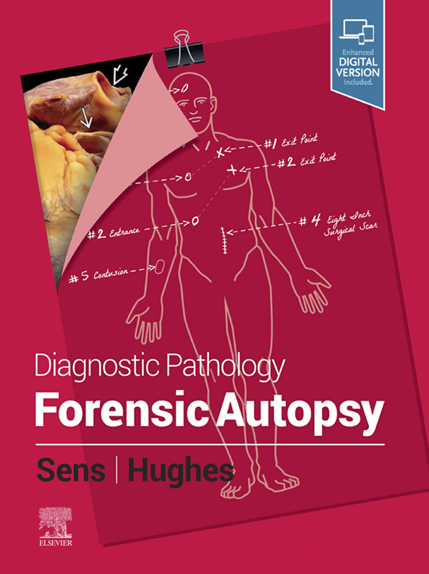 Diagnostic Pathology: Forensic Autopsy: Diagnostic Pathology: Forensic Autopsy E-Book (English Edition)