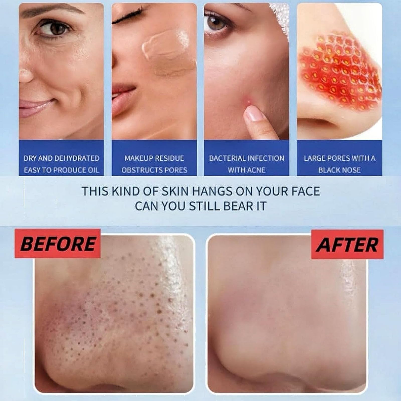 Aspirapunti neri viso profondo con spruzzo d'acqua con microbolle, strumento elettrico per rimuovere punti neri con 6 testine sostituibili, aspirazione regolabile, aspiratore punti (2pcs)