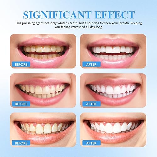 Miniatura 8 de Smile Actives Pro - Gel blanqueador – Pintura de dientes instantánea para uso diario, kit de esmalte líquido seguro y suave que promueve el aliento