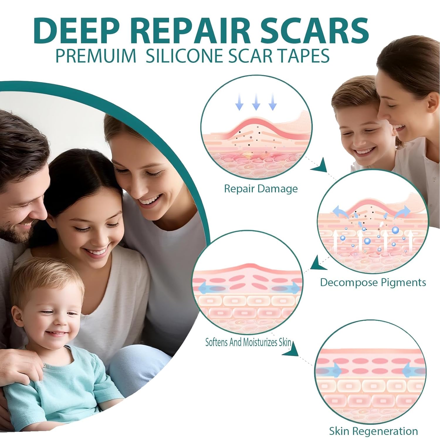 Silicone Scar Sheets,Silicone Scar Tape For Surgical Scars,Silicone Scar Removal Strips For Surgical,C-Section,Tummy Tuck, Keloid Scars Bump Removal (1.6"X 59" Roll-1.5M) - Image 4