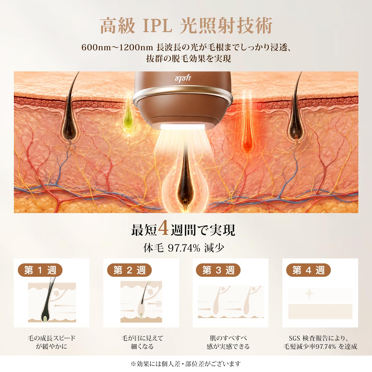 Amazon | YETE 脱毛器 冷感 アイスクリーム脱毛器 10℃恒冷 IPL 湿脱