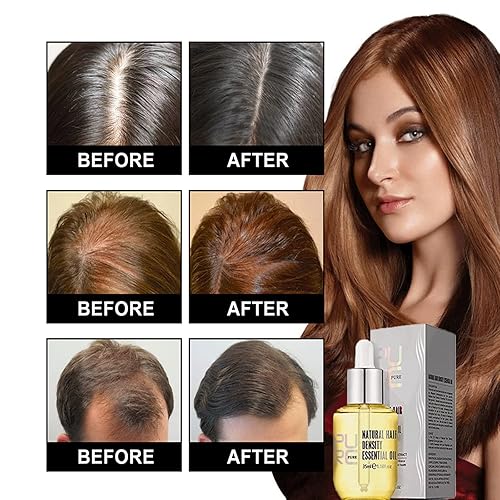 Miniatura 6 de Purc - Aceite esencial para el crecimiento del cabello, aceite esencial de densidad natural del cabello, aceite de esencia de crecimiento del