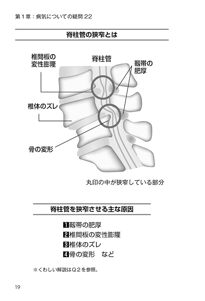 脊柱・腰痛管理専門書3冊セット 楽天市場】【脊柱管狭窄症 大人気3冊】自力で克服！腰の名医が