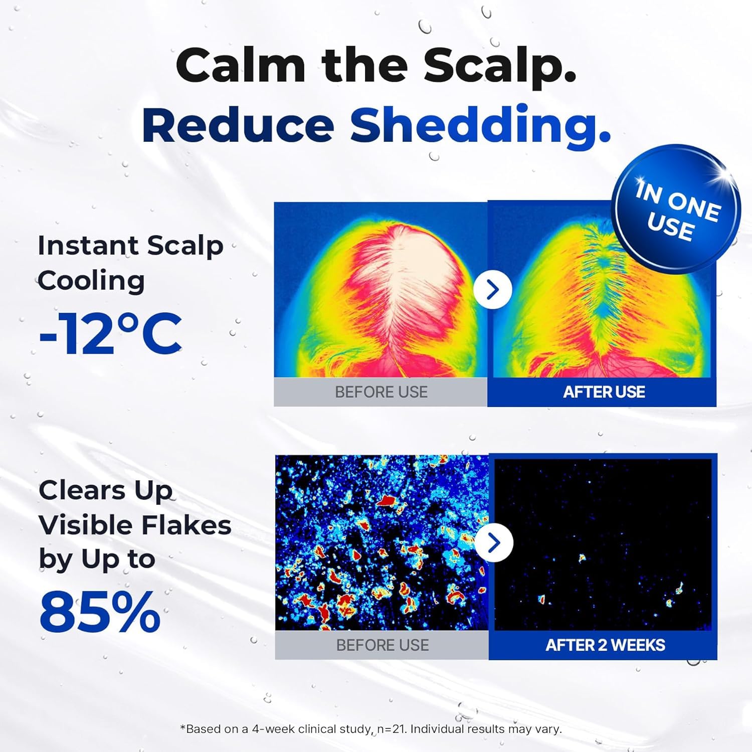 EPAIS Scalp Boosting Serum with 38-Tip Comb Applicator