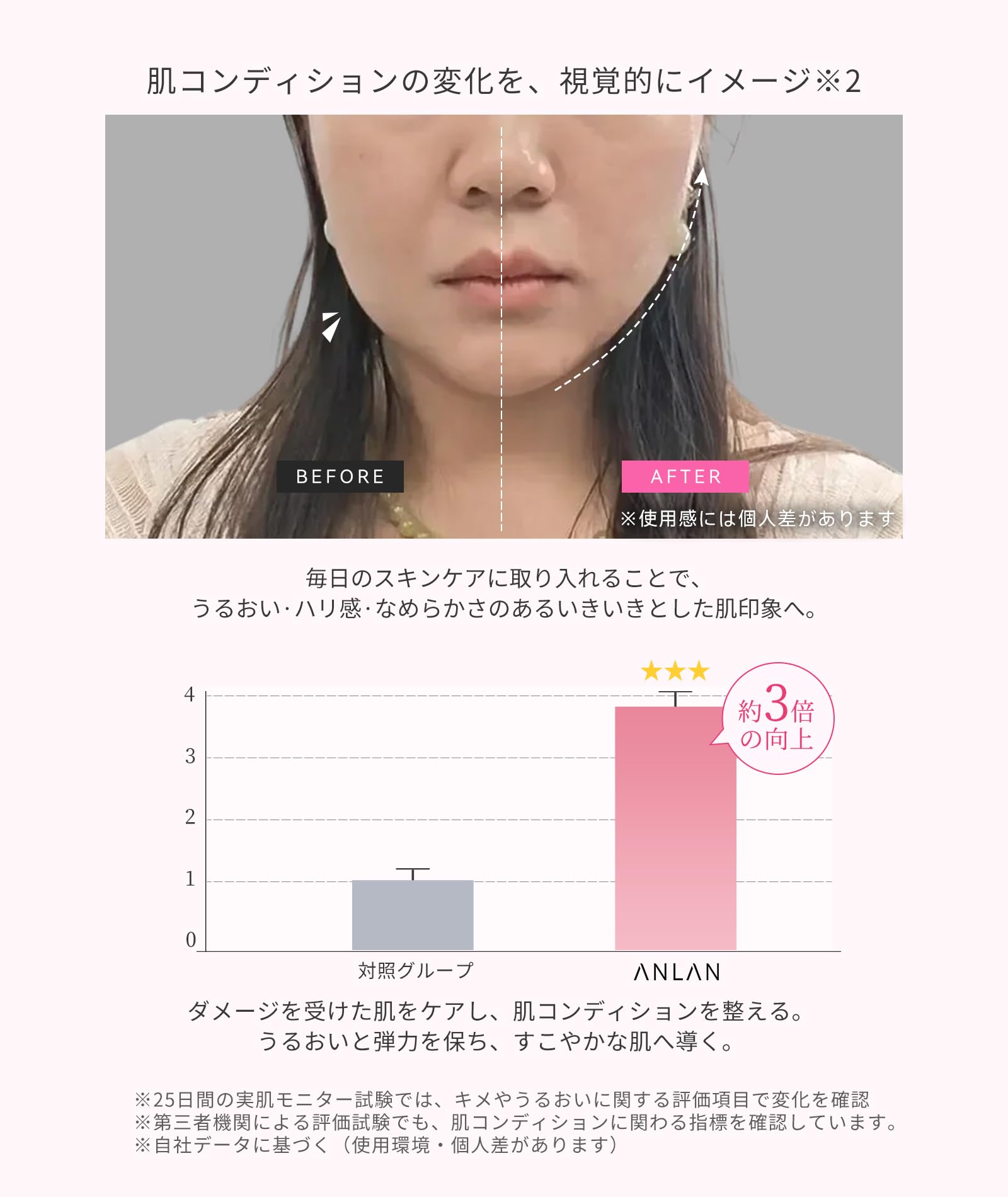 Amazon.co.jp: ANLAN Rose Lumi 美顔器 5分時短美容 ピンクの光で全