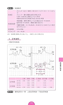 Amazon.co.jp: 脳波・誘発電位検査ポケットマニュアル : 正門由