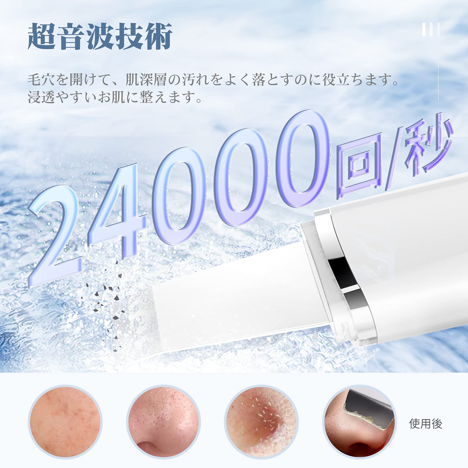 Amazon.co.jp: ANLAN ウォーターピーリング 美顔器 1台4役 温熱ケア