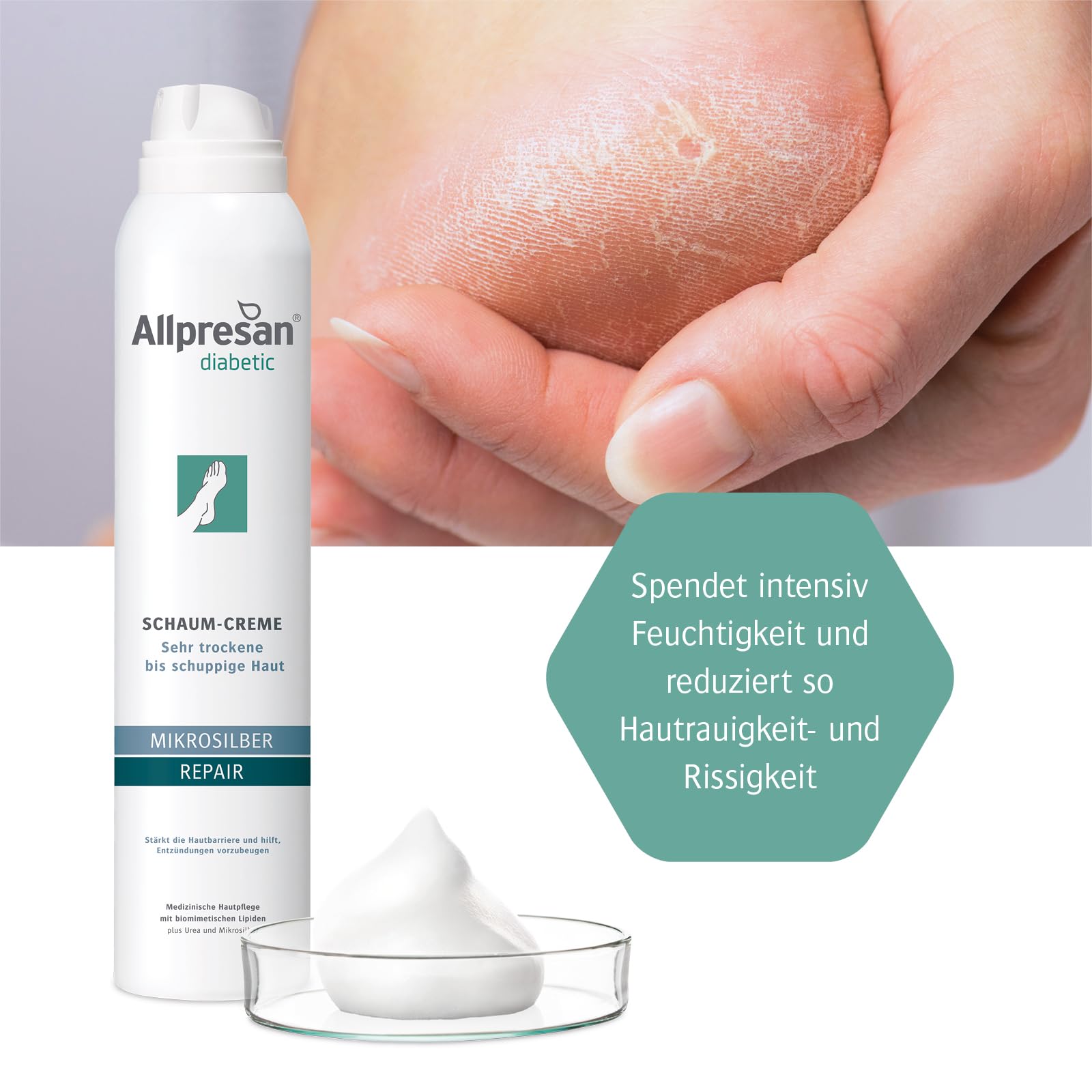 Allpresan Crema de espuma diabética de microplata + repair con microplata para pieles muy secas a escamosas en diabetes mellitus, 200 ml (paquete de 2)