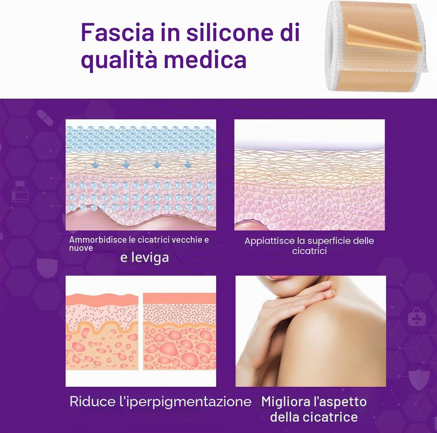 1.5M Fogli di silicone cicatrici 6 mesi di fornitura