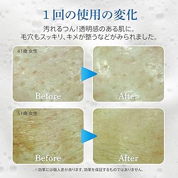 スパークリングパック ZOGANKIN G4U SPARKLING PACK(スパークリングパック） | ZOGANKIN