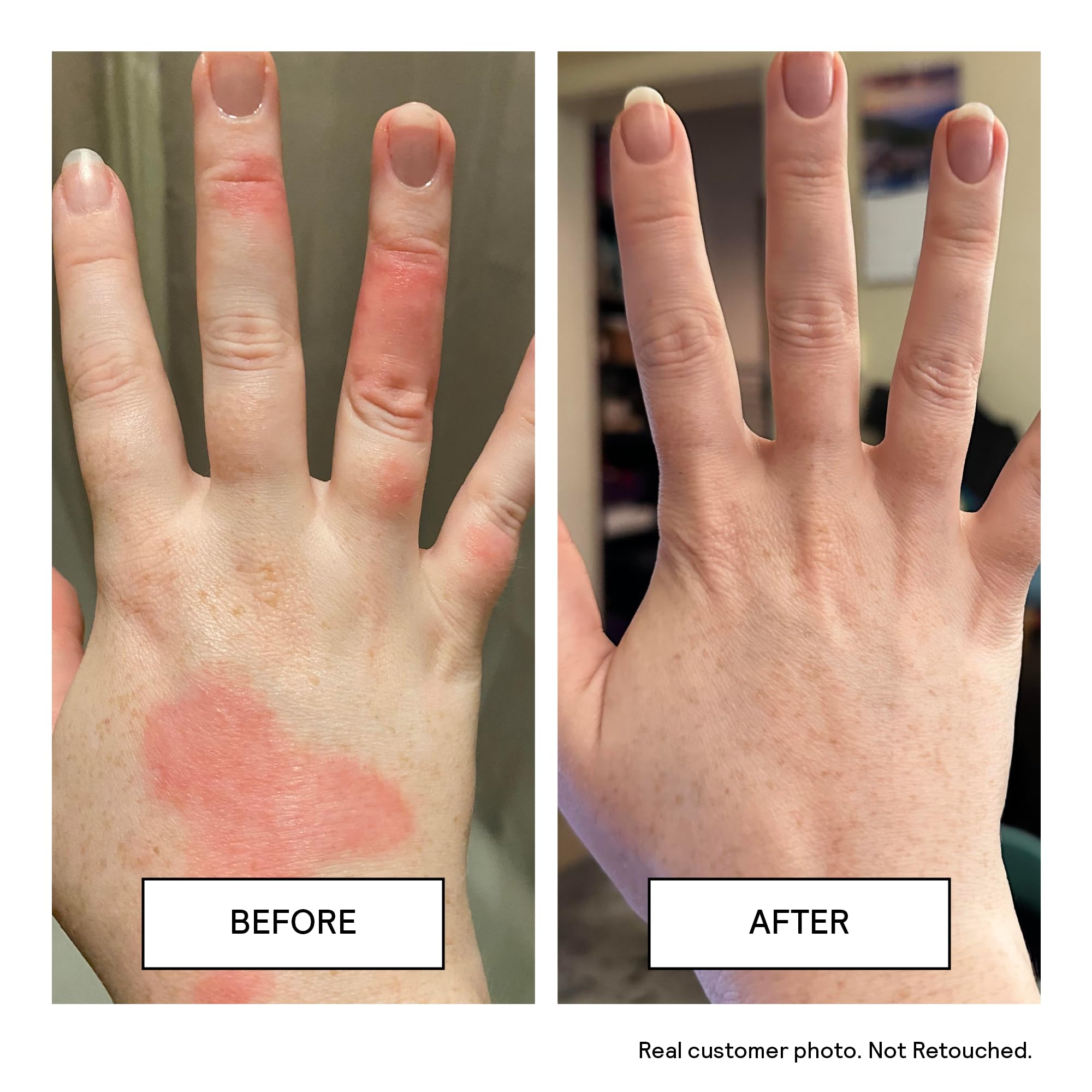 Untoxicated Moisturizing Cream - Facial Moisturizer & Body Cream for Sensitive Skin and NEA Approved for Eczema Relief - Ceramides & Hyaluronic Acid with No Common Irritants