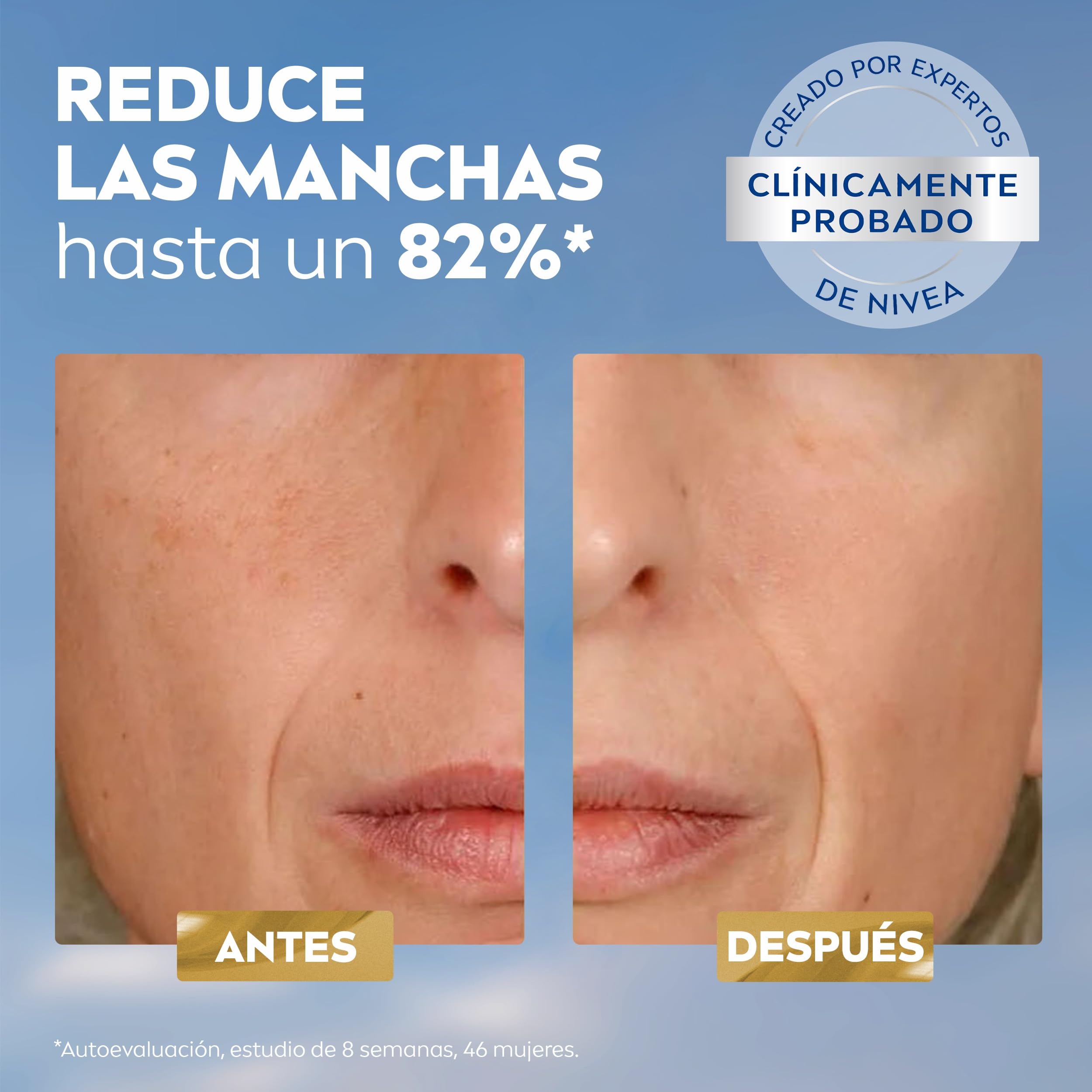 NIVEA Luminous630 - Sérum Antimanchas Tratamiento Avanzado - Sérum Facial con Ácido Hialurónico y Thiamidol Despigmentante - Tono Uniforme de la Piel - Hidratación - Todo Tipo de Piel - 30 ml