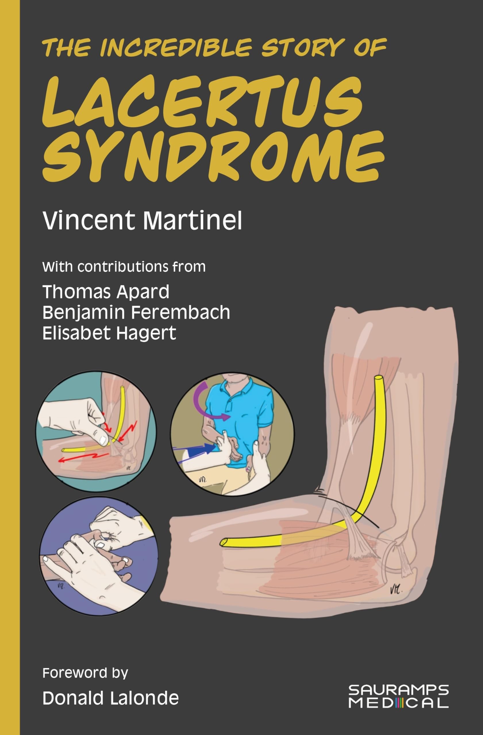 The incredible story of LACERTUS SYNDROME : MARTINEL, Vincent