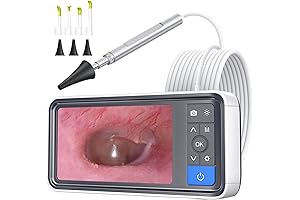 ScopeAround Digital Otoscope with Ear Wax Remover and Camera