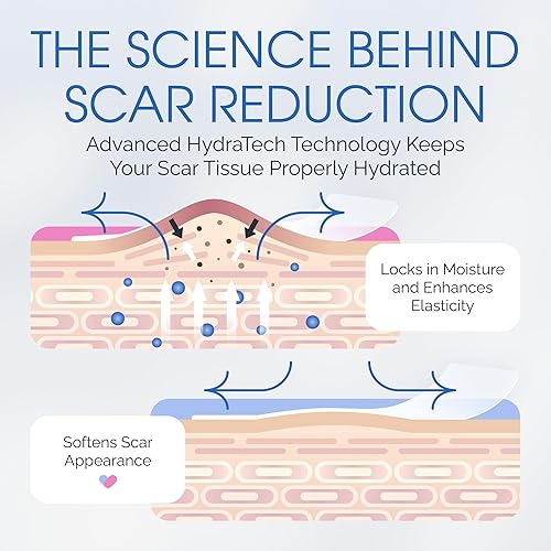 Miniatura 6 de Tiras de silicona para cicatrices de sección C para cicatrices quirúrgicas, abdominoplastia y recuperación posparto, cinta para cicatrices, hojas de