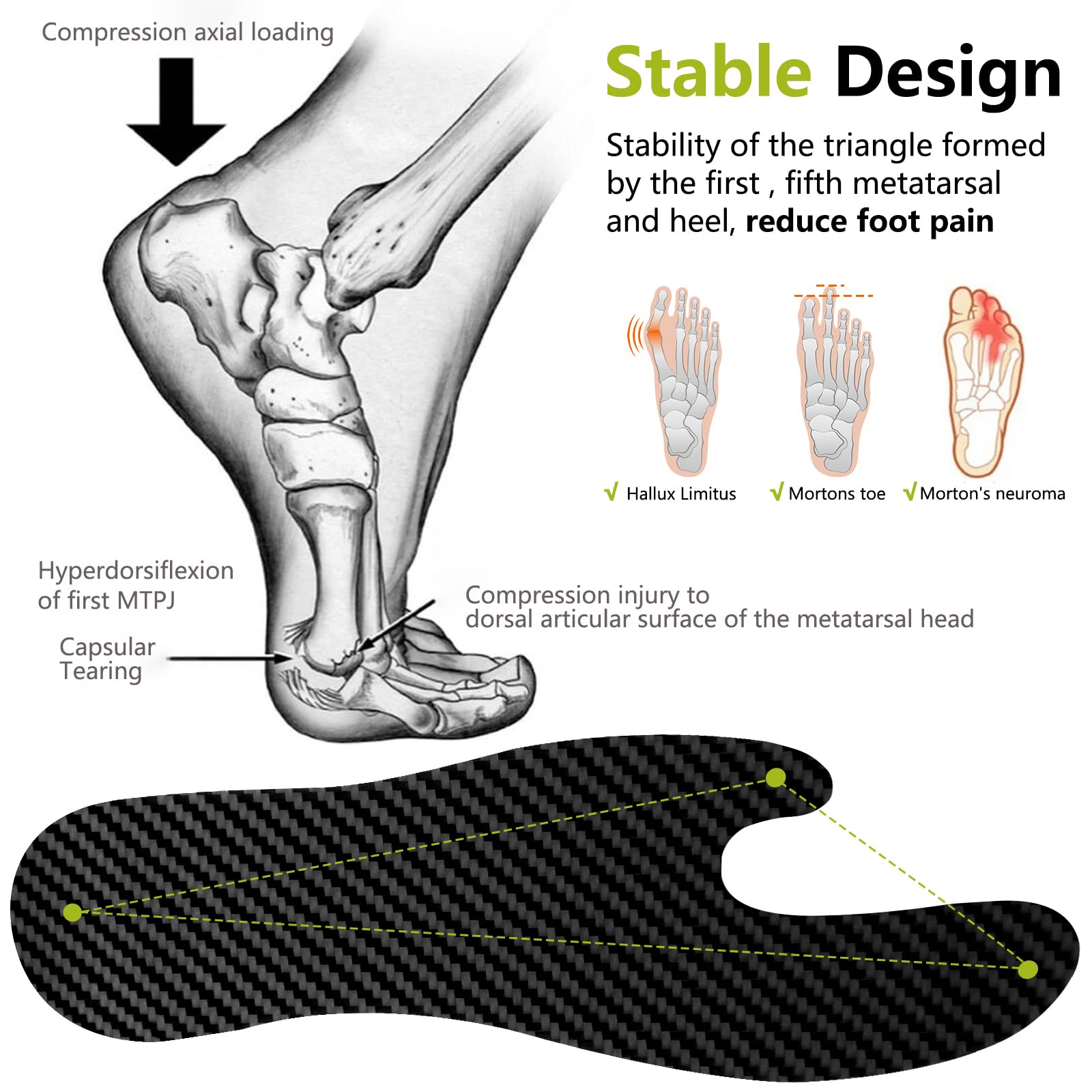 Turf Toe Insole Turf Toe Anatomy Big Toe Joint Pain Sesamoiditis Ohio Podiatric Care