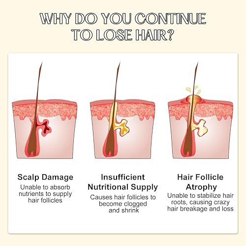 Miniatura 2 de Champú para el cabello con extracto de planta de jengibre, champú para el cabello con extracto de planta de jengibre, champú nutritivo para cabello