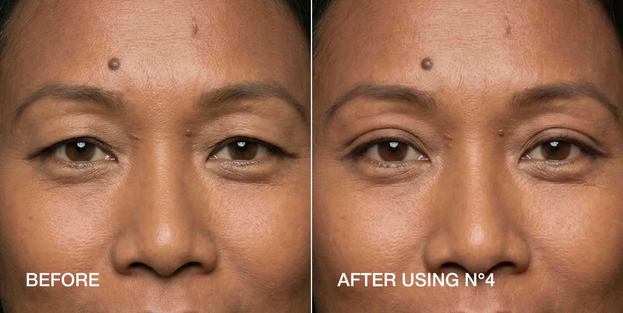 Contours Rx Lid by Design Lot de 80 bandes pour relever les yeux sans chirurgie