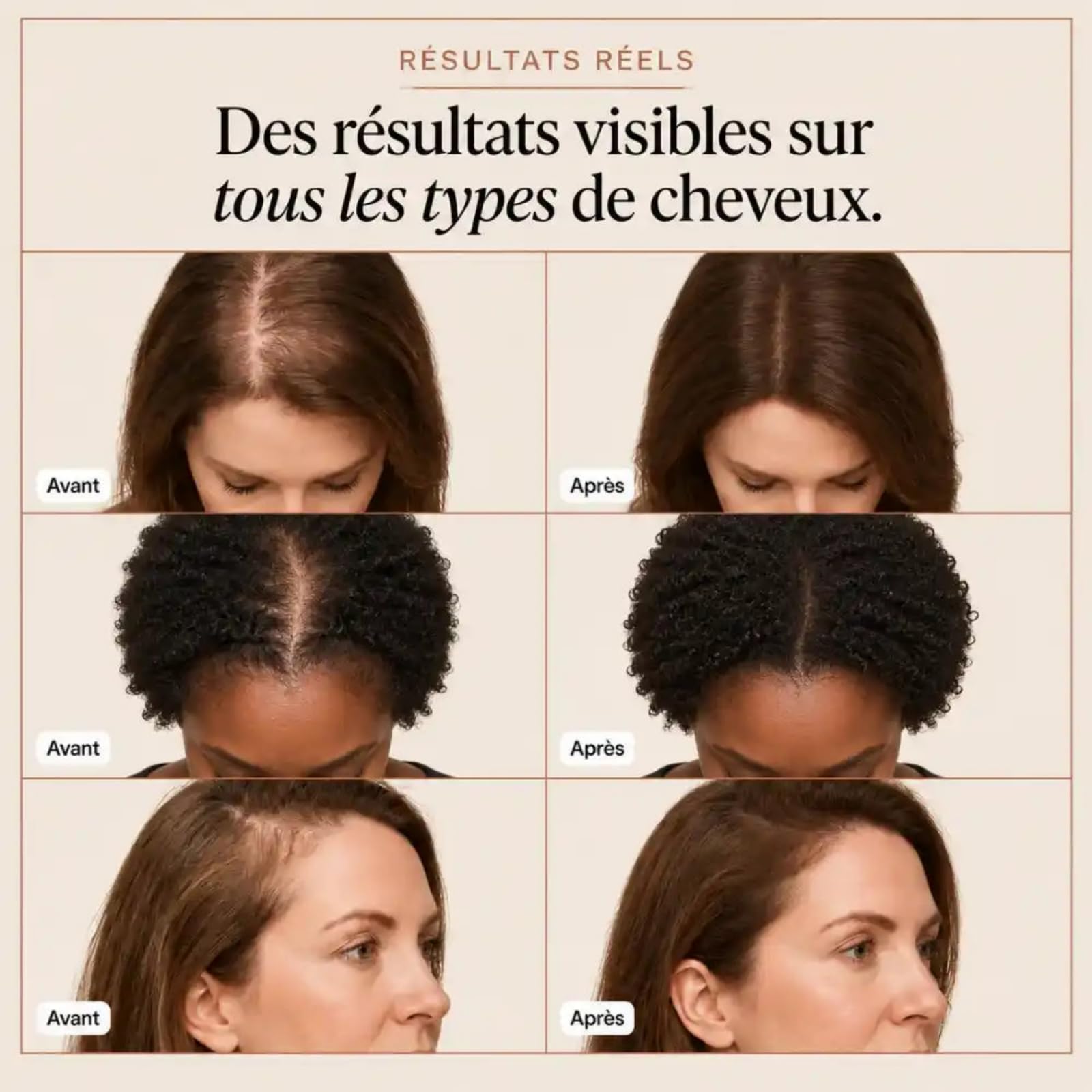 Kavira Serum Capillaire,Kavira Cheveux,Sérum Capillaire avec Brosse Applicatrice Intégrée,Hydratant et Nourrissant,Renforce les Cheveux,Améliore Volume et Densité,pour Hommes et Femmes